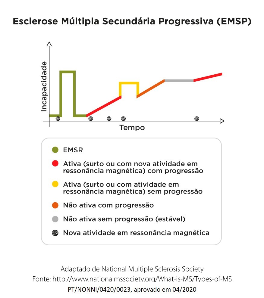 esclerose multipla secundaria progressiva