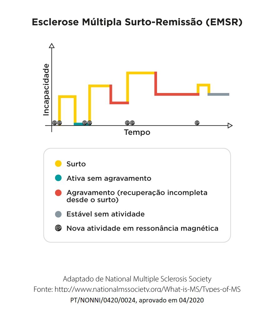esclerose multipla surto remissao